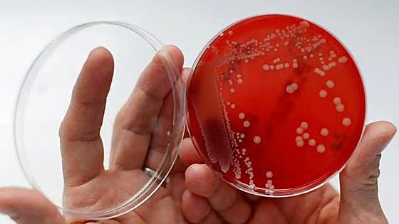 Japan warns of deadly 'flesh-eating' bacteria that could reach Spain