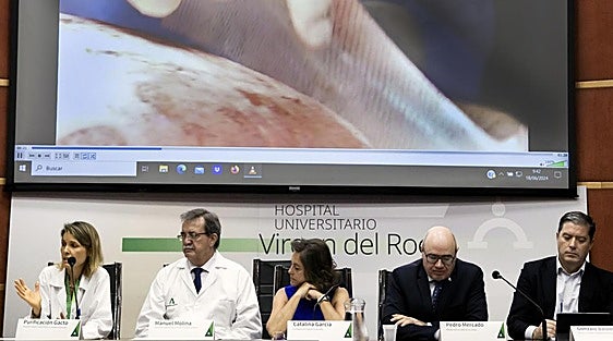 Virgen del Rocío hospital in Seville the first in Spain to get authorisation for use of artificial human skin