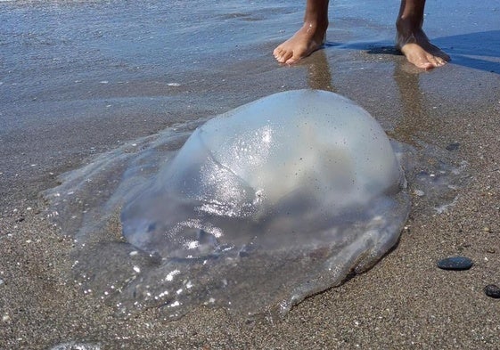 This is how to deal with jellyfish, spider fish and sea urchin stings ...