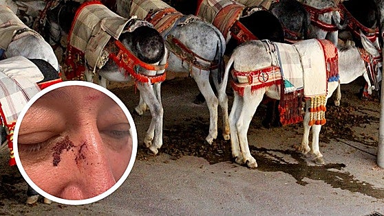 British tourist reports muleteer for allegedly punching him in the face while filming donkeys in Mijas