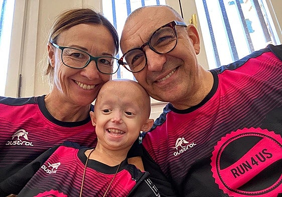 Alexandra, the only child in Spain with an incurable syndrome that accelerates ageing