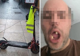 On the left, the stolen scooter and (right) the victim of the attack.
