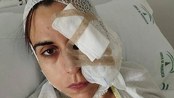 Two-year prison sentences for owners of rottweilers that attacked a five-year-old girl and her mother in Granada town