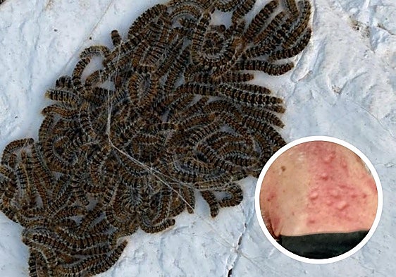 Malaga family besieged by 'plague' of processionary caterpillars: 'It is like being in a horror movie'