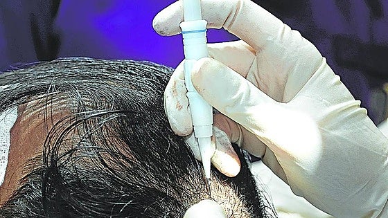 Family of 39-year-old man who died following hair transplant in Spain denied compensation