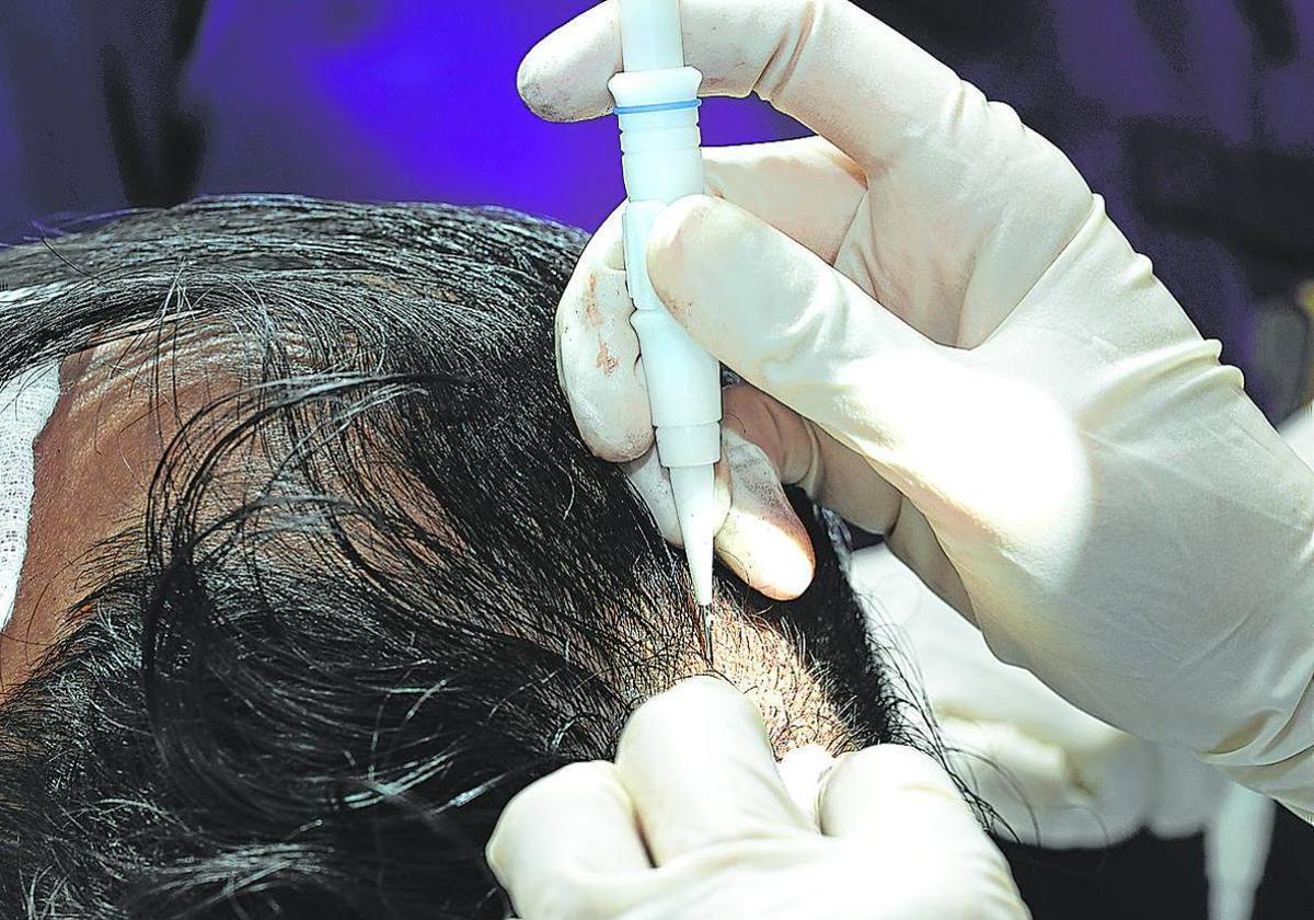 Family of 39-year-old man who died following hair transplant in Spain denied compensation