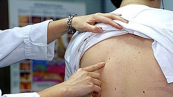 Skin cancer is on the rise in Malaga: these are the latest prevention recommendations from the experts