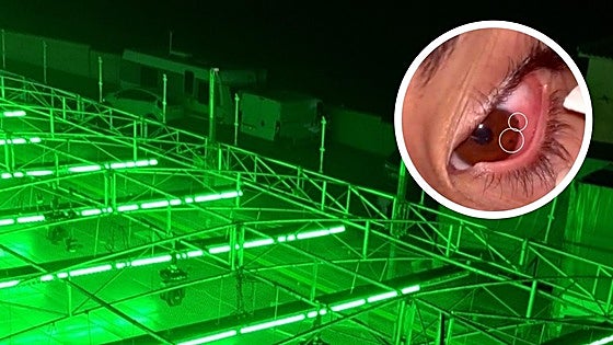 'They have metal in their eyes,' say parents of youngsters injured by bumper car attraction at Valle de Abdalajís fair
