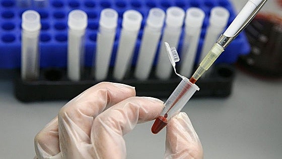 Sexually transmitted infections increase fivefold in Malaga in a decade