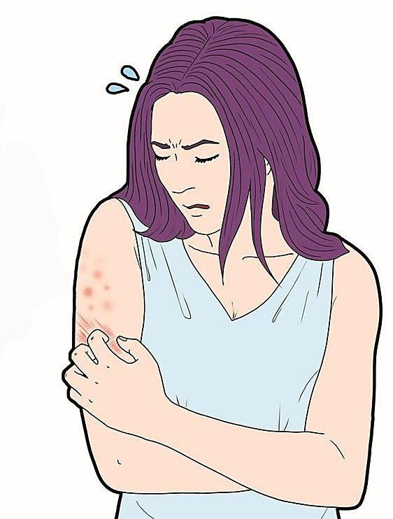 Chronic urticaria: how to live with hives and itching on a daily basis