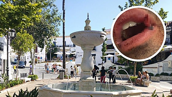 Young musician allegedly punched in face after refusing to play guitar in Mijas