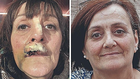 Attack in Spain: 'A dog ripped my mouth open and it’s ruining my life'