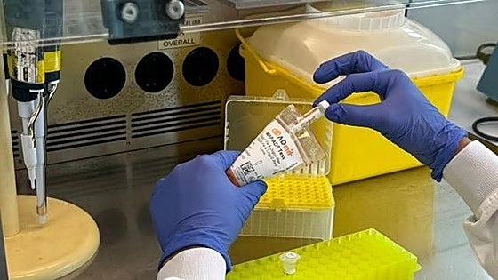 Blood test may be able to predict Parkinson's before first symptoms appear