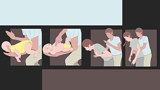 Sweets, meat and more: 65% of choking incidents in children are caused by food