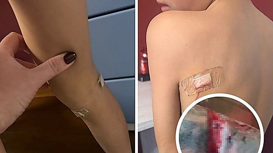 Police denounce owner of dog that attacked two children and two adults in Marbella