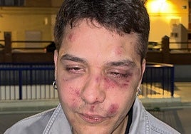 The victim's face after the assault in Malaga.