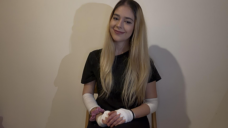 Malaga influencer Micaela with epidermolysis bullosa (Butterfly Skin): daily tips for 140K followers