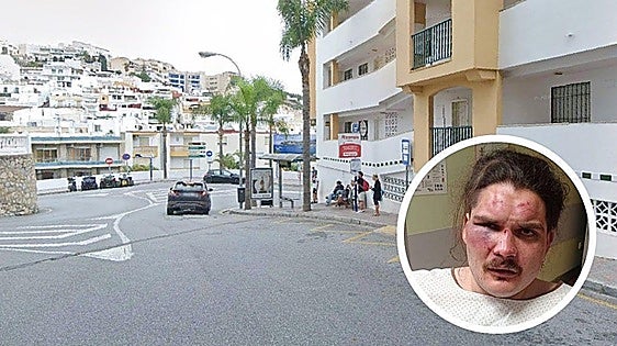 Young man brutally attacked while waiting for a bus on Costa Tropical