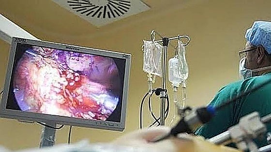 Seven in ten Malaga residents ignore life-saving colon cancer screening invitations