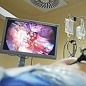 Photo from a colonoscopy.