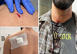 Photos of some of the Fuengirola attack victim's injuries.