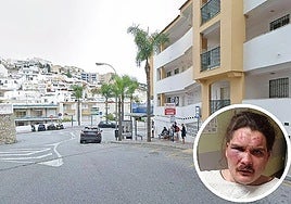 Roberto, the young man who was assaulted, in hospital after being brutally beaten at the entrance to La Herradura.