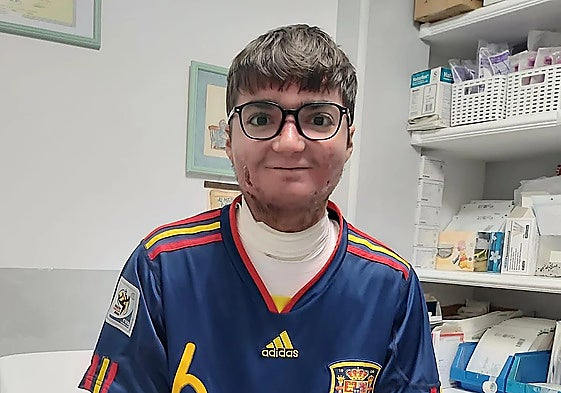 22-year-old Adrián Soto suffers from epidermolysis bullosa, also known as 'butterfly skin'.