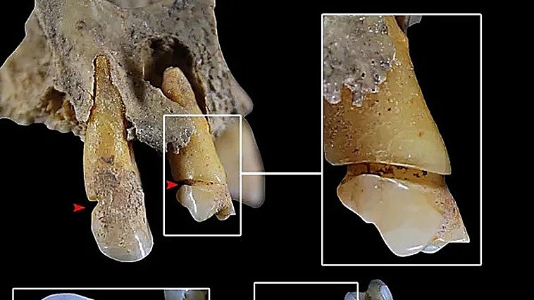 4,000 year-old teeth found in Andalucía reveal gendered division of labour