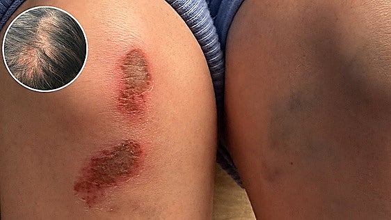 Victim of Periana attack which sparked a demonstration speaks out