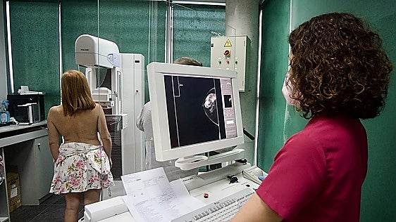 Spain develops calculator to predict likelihood of developing breast cancer over five-year period