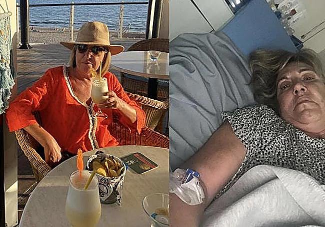 Carmen in 2024, during the summer holidays in the Canary Islands, a few days before she came into contact with the bacterium. In hospital, following the bite, on one of the occasions when she was sent home because ‘everything was fine’