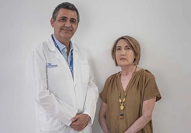 Carmen’s life after a face transplant: ‘I recognise myself by my eyes’
