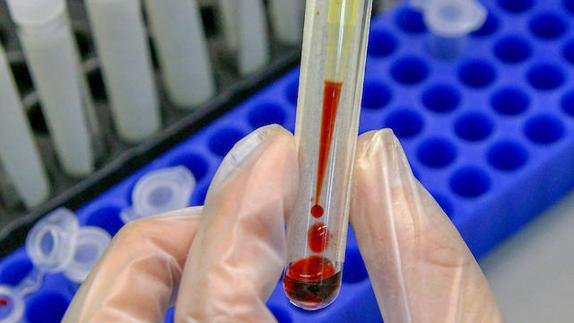 Blood is tested in a lab.