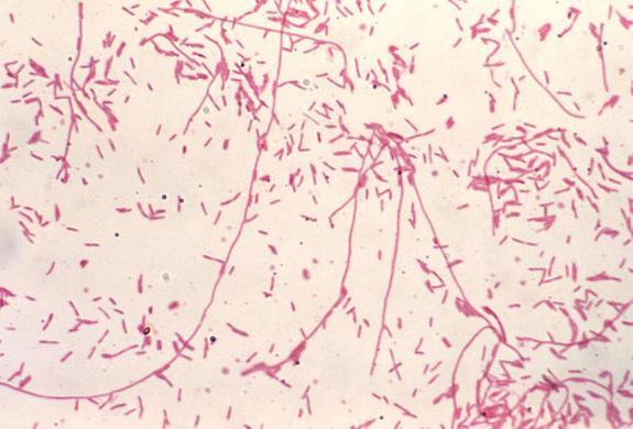 Legionella pneumophila, responsible for 90 per cent of cases. 