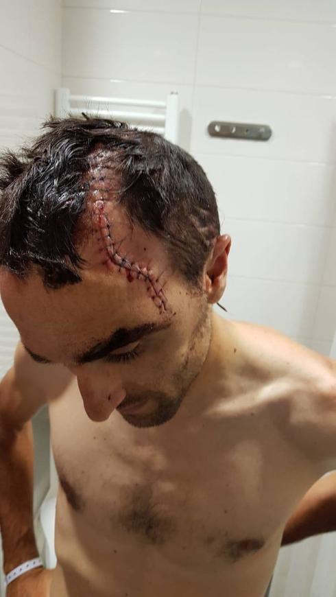 Twenty stitches for Luis Ángel Maté after fall in Tour de Pologne