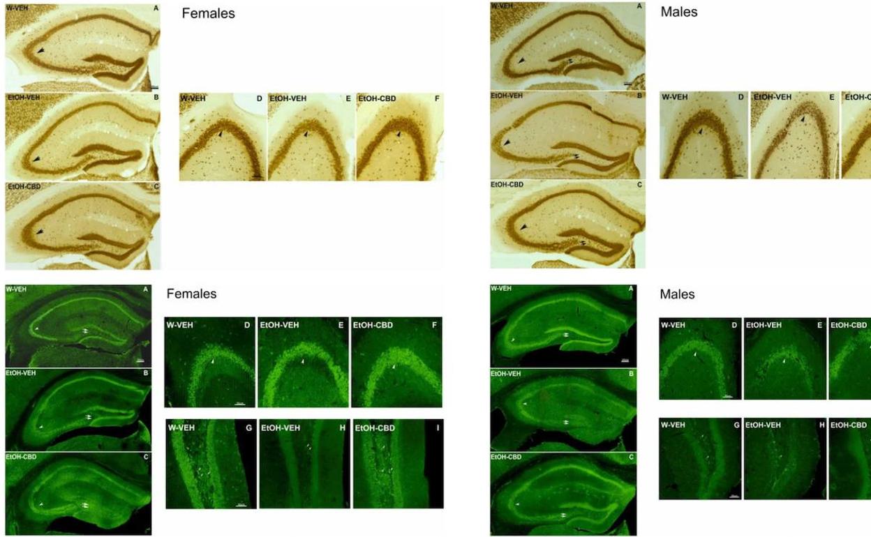 Imágenes de los resultados cerebrales obtenidos por la UMH en ratones machos y hembra.