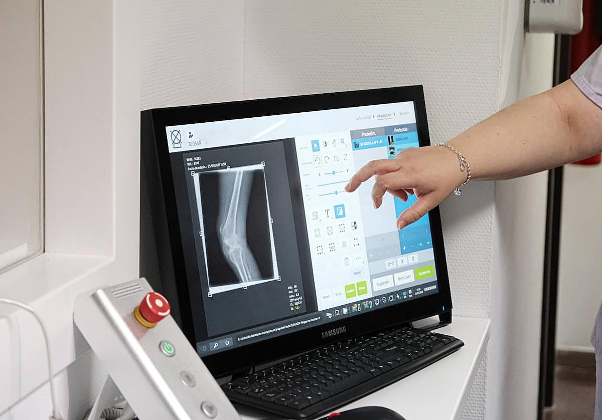 Equipo de readiología en el Hospital General de Alicate.