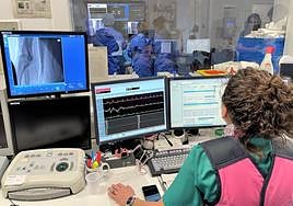 Equipo de cardiología intervencionista del Hospital de Sant Joan.