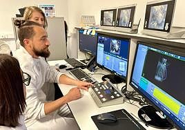 Servicio de Oncología Radioterápica en el Hospital General de Elche.