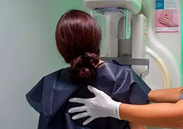 Archivo - Imagen de recurso de mamografía.