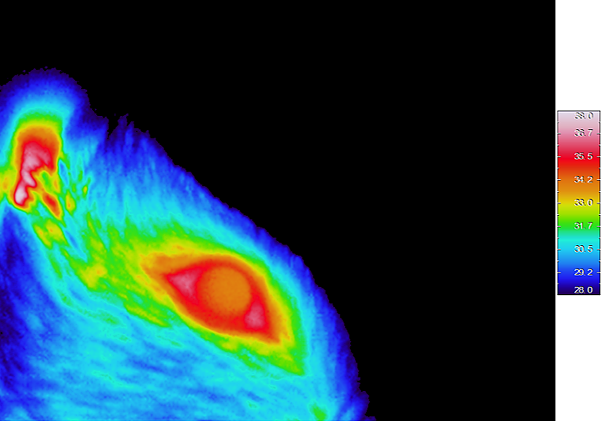 Imagen de termografía por infrarrojo en una rata despierta.