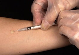 La vacuna contra la rabia está hecha del virus inactivo de la rabia.