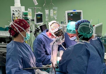 Prótesis 3D personalizadas para tratar tumores en el tórax: nueva técnica para pacientes en Alicante