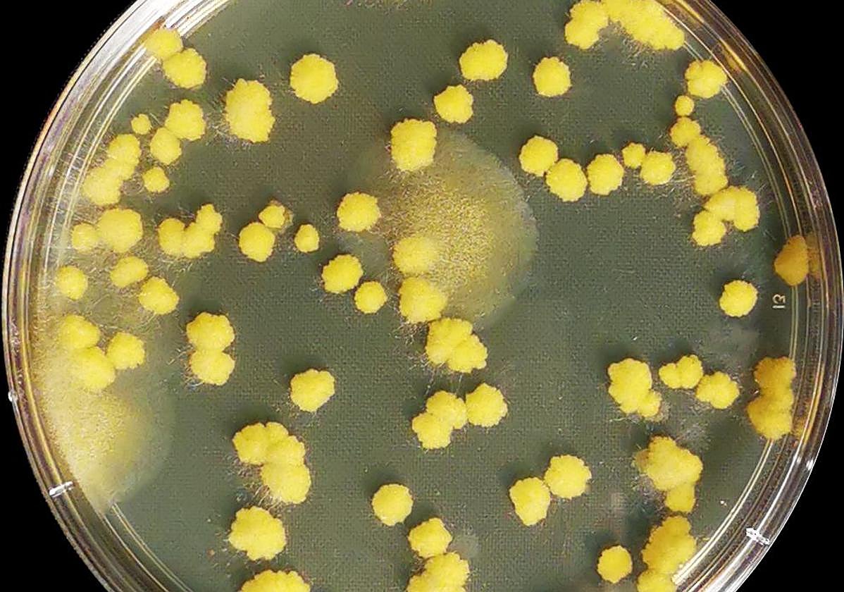 El estudio se ha centrado en el hongo Mucor circinelloides, un patógeno que puede causar infecciones muy graves en personas inmunocomprometidas.