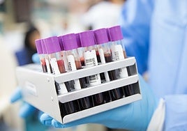 Muestras de sangre en un laboratorio.